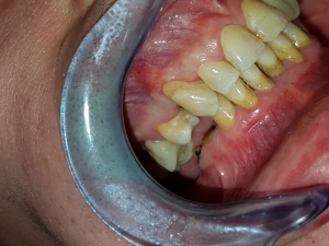 cabinet stomatologic allsmiles dental sector 2 bucuresti dr.sorina dragnea