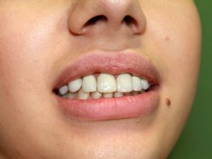 clinica dentara allsmiles dental sector 2 bucuresti dr.sorina dragnea