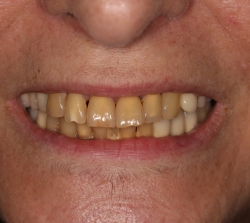 cabinet stomatologic allsmiles dental sector 2 bucuresti dr.sorina dragnea